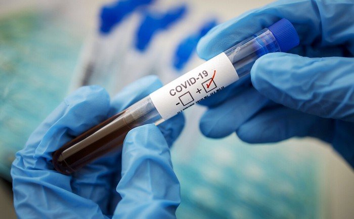 На Хмельниччині майже на 60% зросла кількість хворих на COVID-19