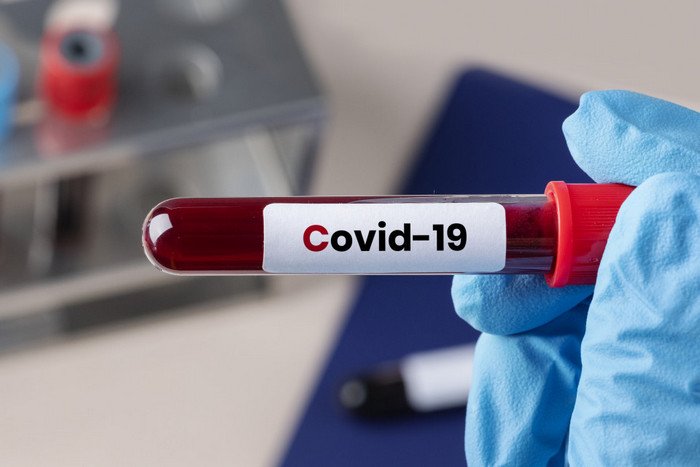COVID-19 на Хмельниччині: від ускладнень померли 14 людей